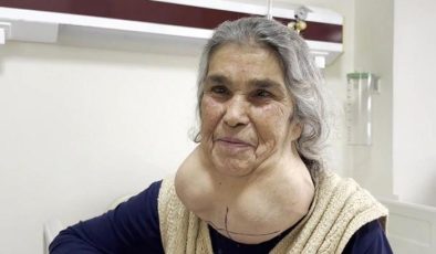 50 yıl boyunca hastaneye gitmedi, 2 kiloluk kitleyle 50 yıl yaşadı