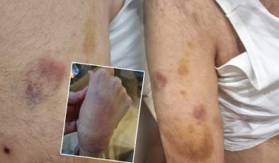 Zihinsel engelli öğrenciye öğretmen şiddeti: İşkence görmüş, dayak değil