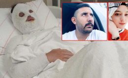 ‘Su sayacına bakacağız abla’ dedi, yüzüne kimyasal attı! 15 yıl ceza az bulundu